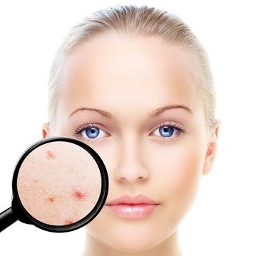 How To Get Healthy Skin
