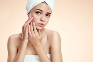 Dermalogica Face Mapping skin analysis near me