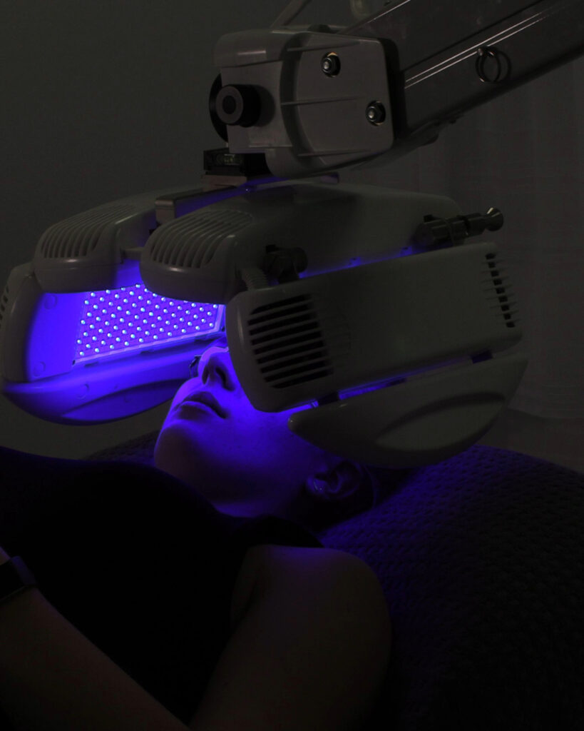 Dermalux blue light therapy preston beauty salons